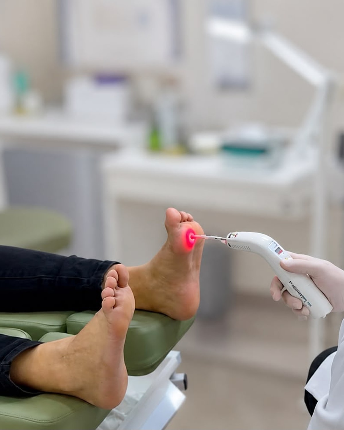 Prof. Jonas Campos aplicando laser no pé diabético